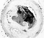 upjohn1.jpg (4749 bytes)