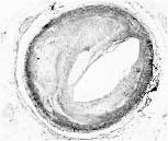 upjohn2.jpg (4419 bytes)