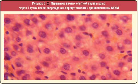 Рисунок 5 : : Паренхима печени опытной группы крыс через 7 суток после повреждения парацетамолом и трансплантации СККМ